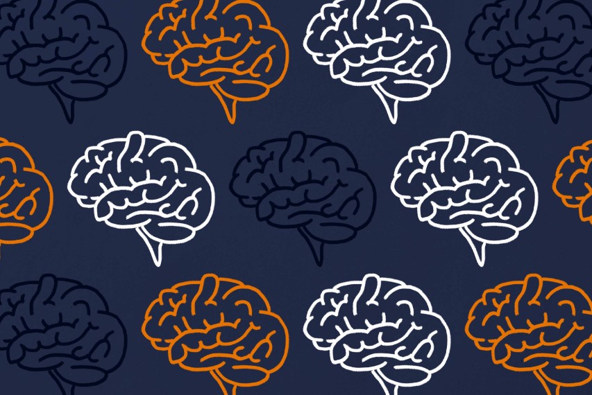 Brain imagery