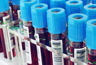 COVID-19: Antibody Testing to Reveal Extent of Infections Across Virginia