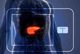 FDA Approves UVA-Developed Artificial Pancreas
