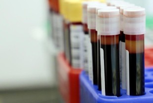 Blood Discoveries Advance Effort to Grow Organs, Battle Cancer