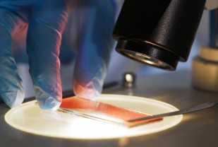 New Organelle That Helps Prevent Cancer Discovered Inside Our Cells