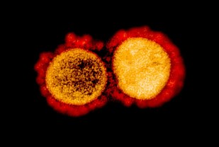 Q&A: What to Know About the 'Delta' Variant and Current Vaccines