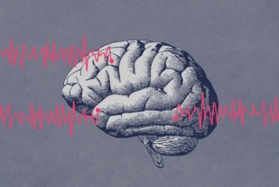 Epilepsy Research Reveals Previously Unknown Trigger for Seizures