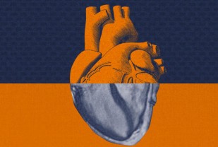 New Artificial Intelligence Technology Poised to Transform Heart Imaging