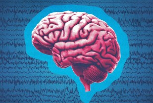 Major Epilepsy Study Offers Much-Needed Answers on 3 Lifesaving Seizure Drugs