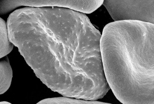 New Approach to DNA Research Could Be Key to Solving Mysteries of Deadly Diseases