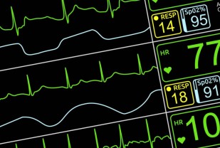 UVA Discovery Reveals Potential Way to Prevent Heart Attacks, Strokes