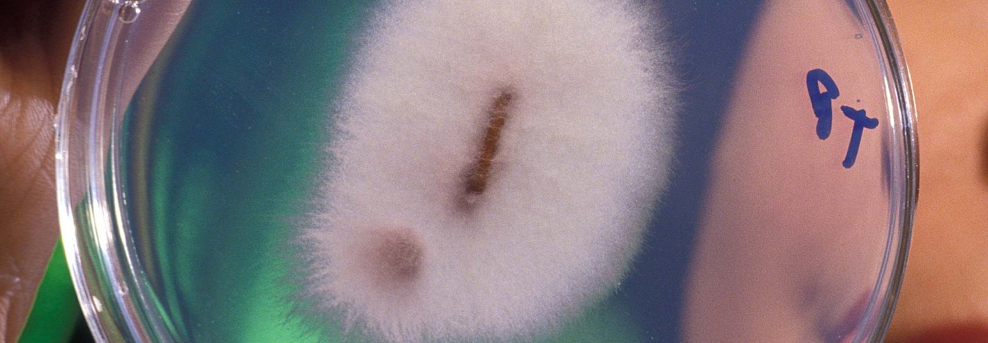 What's Eating You? 5 Fascinating Facts About Parasites