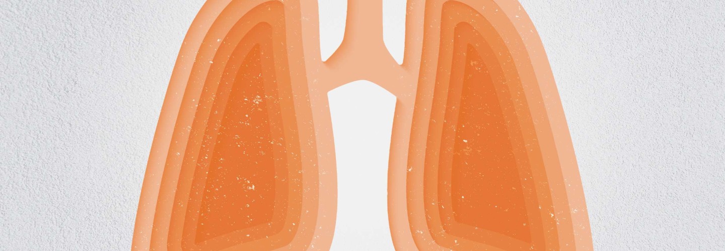 No Simple Fix: Time May Be the Most Reliable Cure for a Chronic Cough