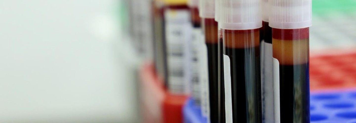 Blood Discoveries Advance Effort to Grow Organs, Battle Cancer