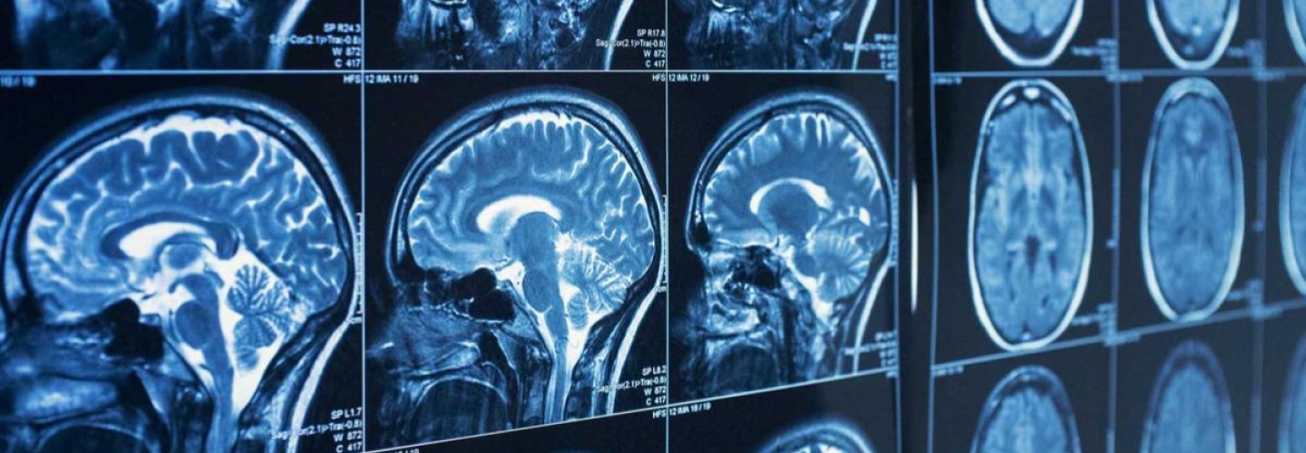 Cancer Find Up for Year's Biggest Biomedical Advance in a Different 'March Madness'