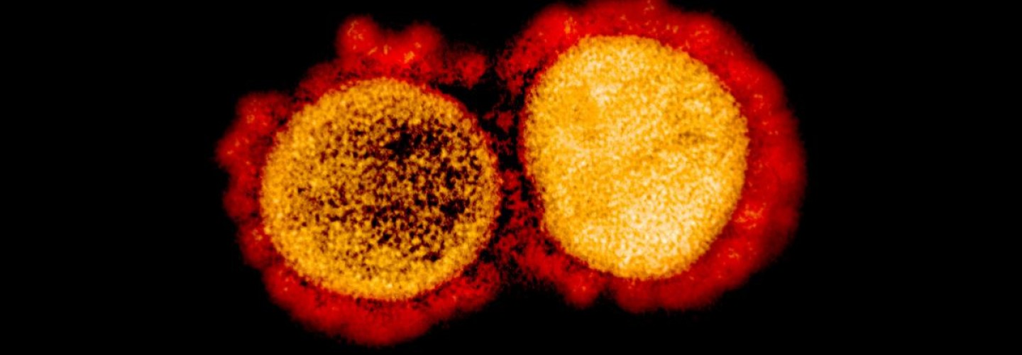 Q&A: What to Know About the 'Delta' Variant and Current Vaccines