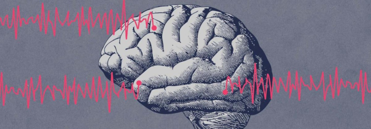 Epilepsy Research Reveals Previously Unknown Trigger for Seizures