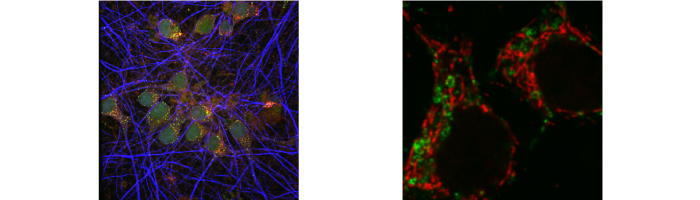 Neuronal Mitochondria  2-photon in Vivo FLIM imaging obtained from Dr. Periasamy’s lab, Keck Center for Cellular Imaging, Department of Biology