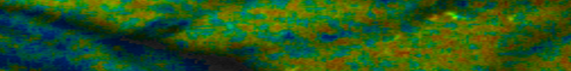 2-photon in Vivo FLIM imaging obtained from Dr. Periasamy, Keck Center for Cellular Imaging