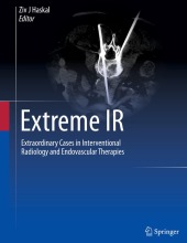 Extraordinary Cases in Interventional Radiology and Endovascular Therapies